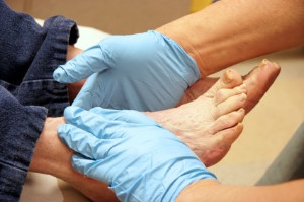 What Is Diabetic Limb Salvage?